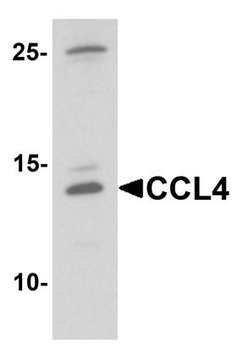 CCL4/MIP-1 Beta Antibody