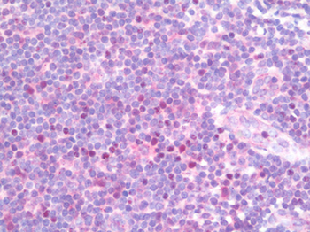 TBX21/T-bet Antibody