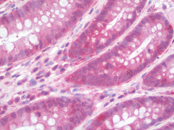 IL36RN/IL1F5 Antibody