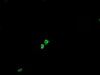GLB1/Beta-Galactosidase Antibody