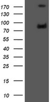 GLB1/Beta-Galactosidase Antibody