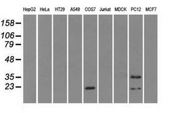CRYAB/Alpha B Crystallin Antibody