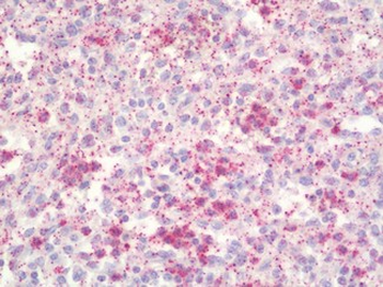 LCN2/Lipocalin 2/NGAL Antibody