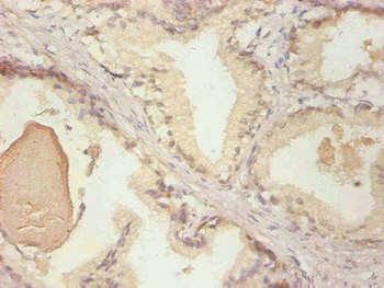LCN2/Lipocalin 2/NGAL Antibody