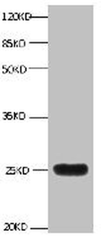 LCN2/Lipocalin 2/NGAL Antibody