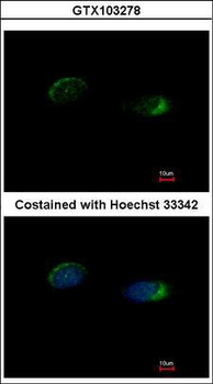 HOMER1/Homer 1 Antibody
