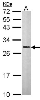 DCXR Antibody