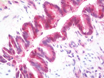 GSTT1 Antibody