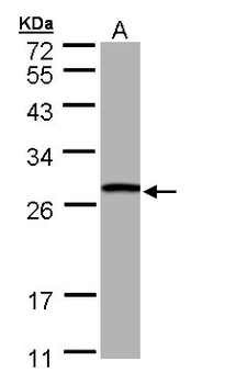 GSTT1 Antibody