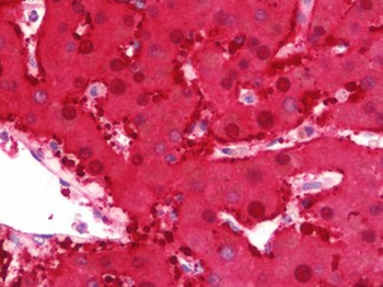 DDH/AKR1C1 Antibody