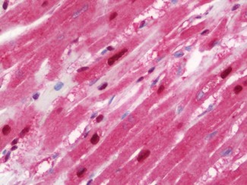 HSPA6/HSP70B' Antibody