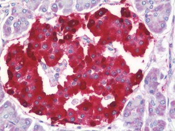 SCG2/Secretogranin II Antibody