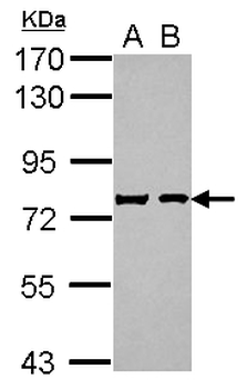 SCG2/Secretogranin II Antibody