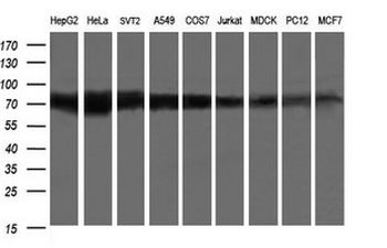 GLB1/Beta-Galactosidase Antibody
