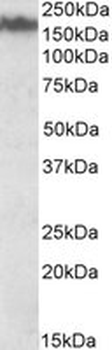 NEFM/NF-M Antibody
