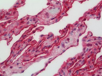 CD55 Antibody