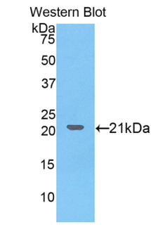 COL8A1/Collagen VIII Alpha 1 Antibody