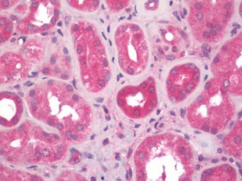 CCBL1 Antibody