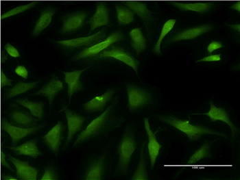 CCBL1 Antibody