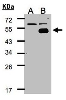 NR2F1/Coup-TF Antibody