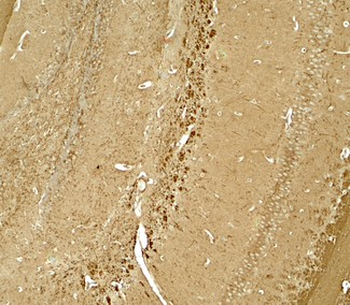 NINJ1/Ninjurin Antibody