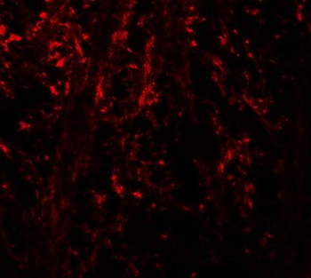 NINJ1/Ninjurin Antibody