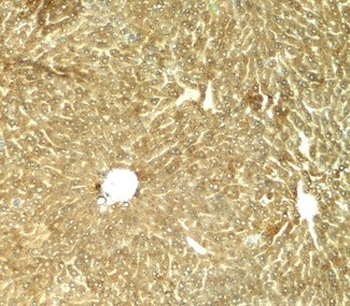 TRB3/TRIB3 Antibody