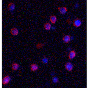 IQSEC1 Antibody
