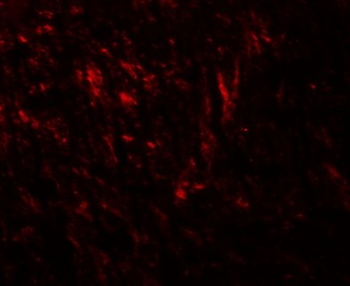 TNM/Teneurin-1 Antibody