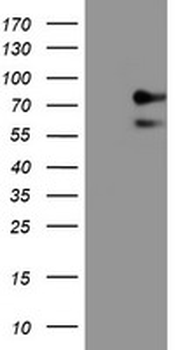 ALOX15/15-Lipoxygenase Antibody
