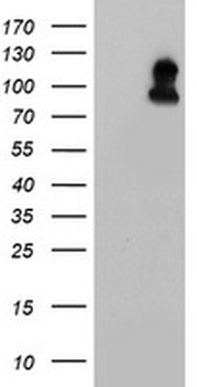 FOLH1/PSMA Antibody