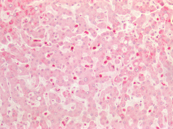 EIF4EBP1/4EBP1 Antibody