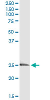 Endothelin 3/EDN3 Antibody