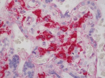 FCGR1A/CD64 Antibody