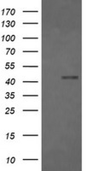FCGR1A/CD64 Antibody
