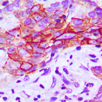 CHEMR23/CMKLR1 Antibody
