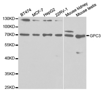 GPC3/Glypican 3 Antibody