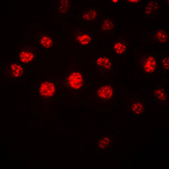 HOXA1 Antibody