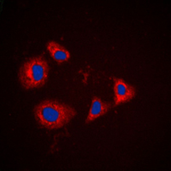 PRKAR1A Antibody