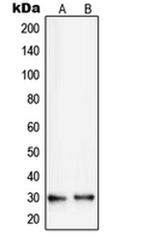 RPS8/Ribosomal Protein S8 Antibody