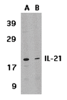 IL21 Antibody