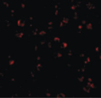IL23A/IL-23 p19 Antibody