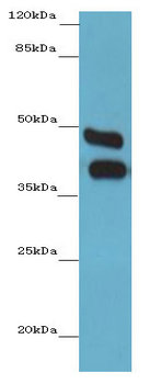 CA12/Carbonic Anhydrase XII Antibody
