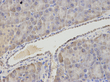 ASNS Antibody