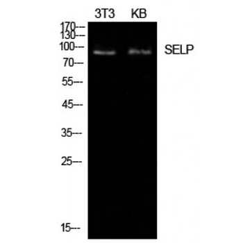 SELP/P-Selectin/CD62P Antibody