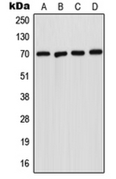 SMPD1/Acid Sphingomyelinase Antibody