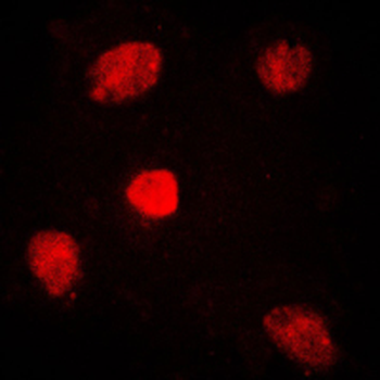 MED1/TRAP220 Antibody