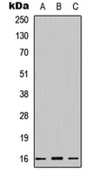 CST1/Cystatin SN Antibody