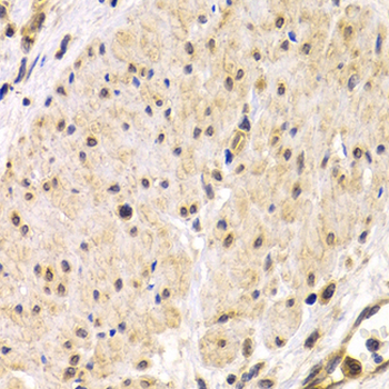 TMPRSS2/Epitheliasin Antibody