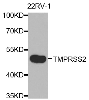TMPRSS2/Epitheliasin Antibody
